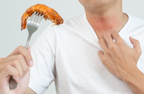 Food-Allergies-in-Texas