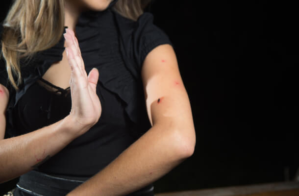Insect-Sting-Allergies-in-Texas