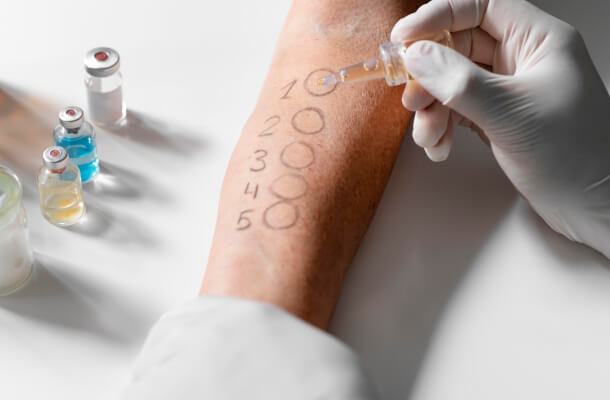 UHS-Allergy-Testing