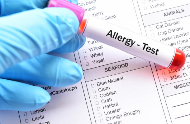 allergy-testing